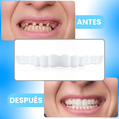 HappySmile® Carillas Dentales Ajustables 😆🦷 2x1🎁